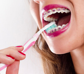 brushing braces image