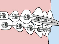 loosewires image