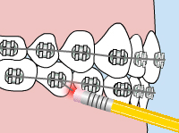 poking wire image