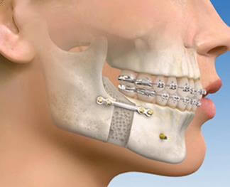 surgical ortho image